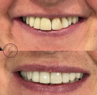 Dra Carolina Guesse , odontologia e estética avançada em são bernardo do Campo, São Paulo