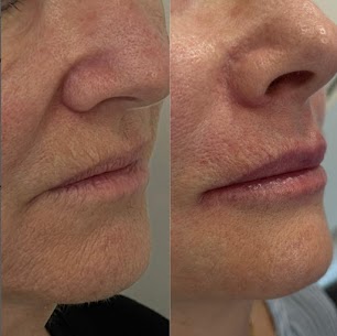 Dra Carolina Guesse , odontologia e estética avançada em são bernardo do Campo, São Paulo