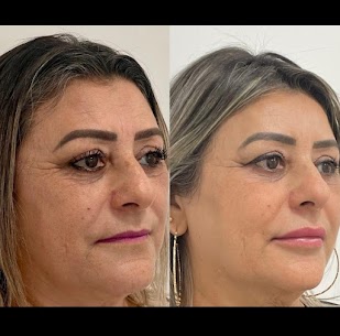 Dra Carolina Guesse , odontologia e estética avançada em são bernardo do Campo, São Paulo