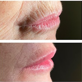 Dra Carolina Guesse , odontologia e estética avançada em são bernardo do Campo, São Paulo